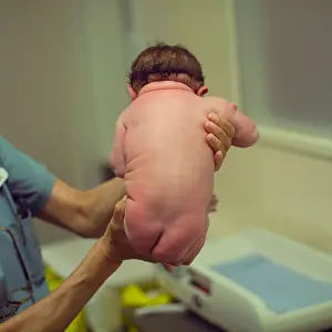 Ward Prints: New Born Baby