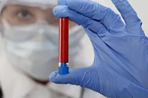 Test Tube Prints: A nurse holds a test tube with blood in her hand