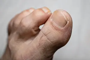 Toes Prints: Older man feet fingers - dry skin - Shallow focus blur background