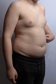 Obese Prints: An overweight caucasian teenage boy showing his stomach while standing