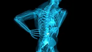 Inflammation Prints: Back pain, conceptual illustration
