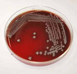 Healthcare And Medicine Prints: Petri dish containing a sheep's blood agar medium