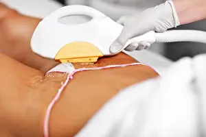 Shaving Prints: Picture Of Beautician Giving Epilation Laser Treatment To Woman On Bikini