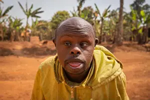 Cameroon Prints: portrait of an adult bald African man with Down syndrome, on a forest background