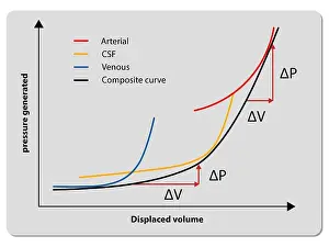 Checkup Prints: Pressure volume curve, increased intracranial pressure