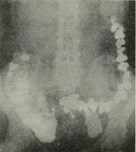 Bookpublisherlondo Prints: Radiography, x-ray therapeutics and radium therapy