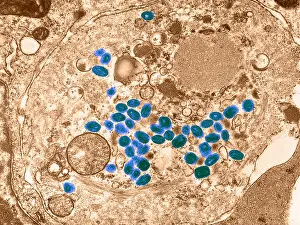 Magnified Prints: Smallpox virus, TEM