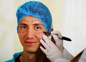 Rejuvenation Prints: Surgeon drawing marks on male face. Plastic surgery concept
