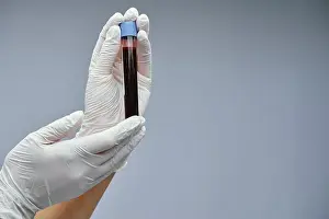 Glove Prints: Taking a blood test