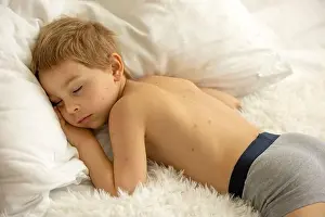Sickness Prints: Toddler boy with chicken pox, lying in bed with fever, mother checking him with worry