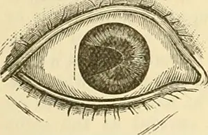 Bookyear Prints: A treatise on the diseases of the eye