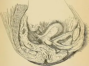 Treatise on gynæcology : medical and surgical