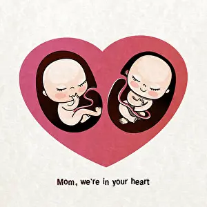 Uterus Prints: Twins or twins in the mother's womb
