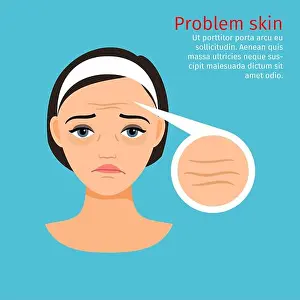 Sensitive Prints: Woman face problem skin with wrinkles, vector illustration